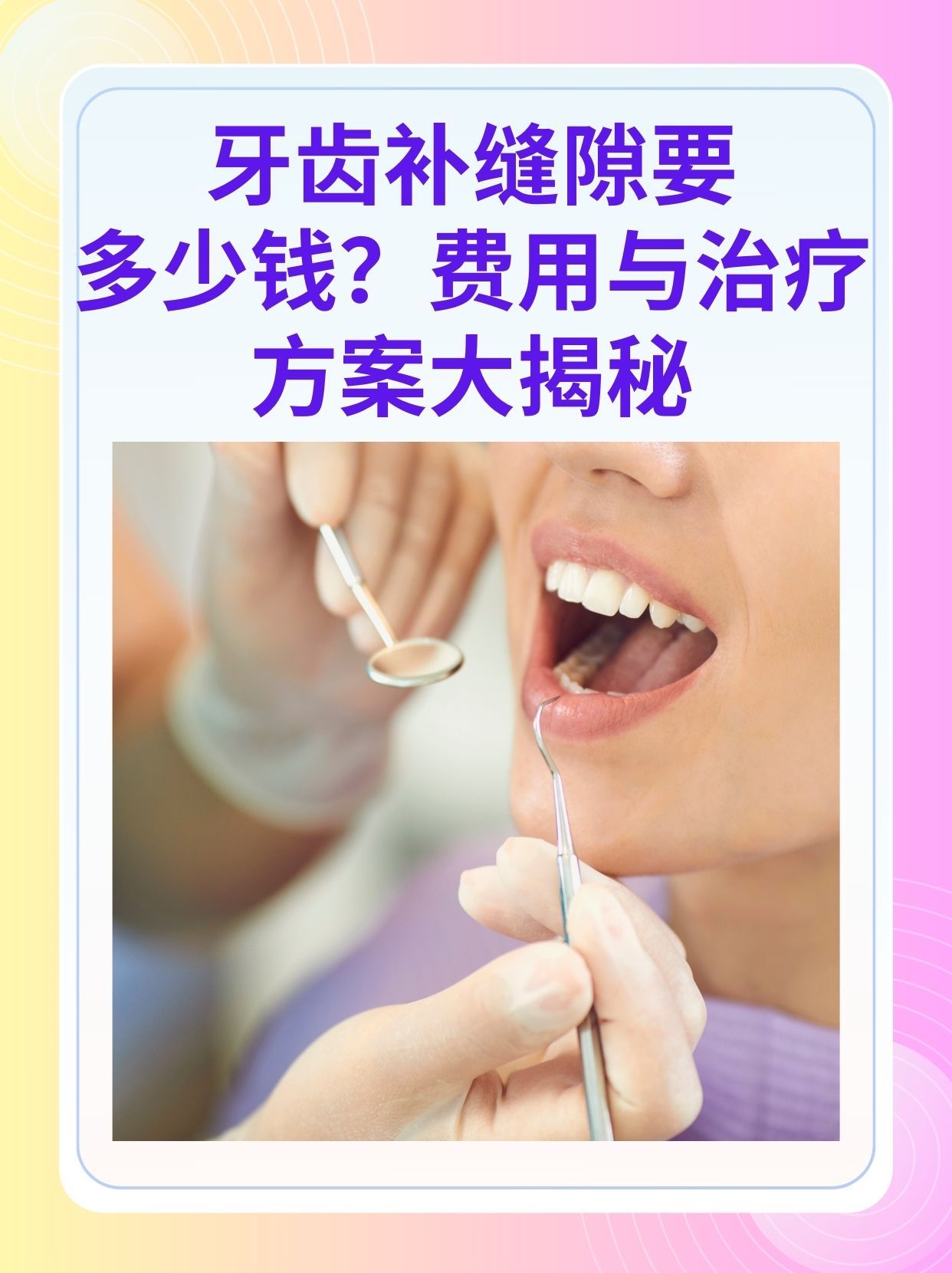 潮州补牙医保可以报销吗(补牙医保可以报销吗 哪些可以报销呢)